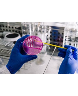 Elikadurak zure tratamenduan eragiten duenean: Sintrom kasua